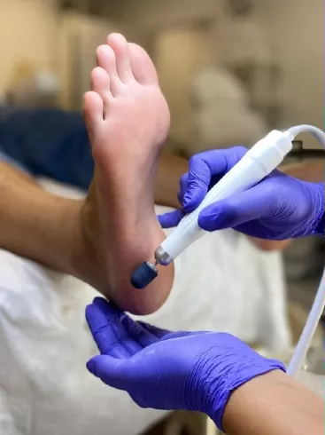 Cracked Heel Care in Troy, MI